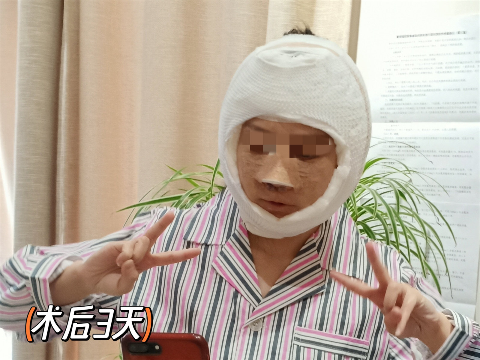 36岁做了拉皮手术,结合亲身感受,回复大家的3个问题 36岁做了拉皮手术,结合亲身感受,回复大家的3个问题