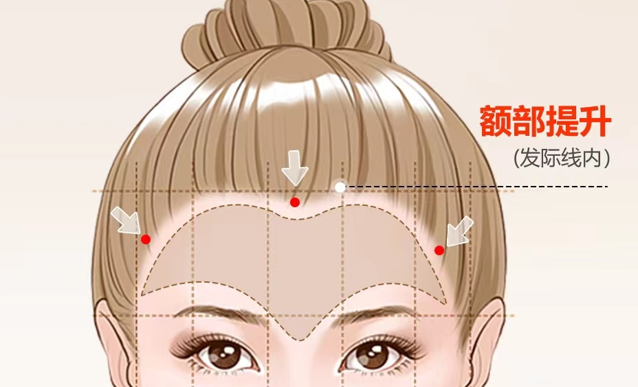 额纹“杀手”来了!额部每一道纹路都可以被抹平 额纹“杀手”来了!额部每一道纹路都可以被抹平