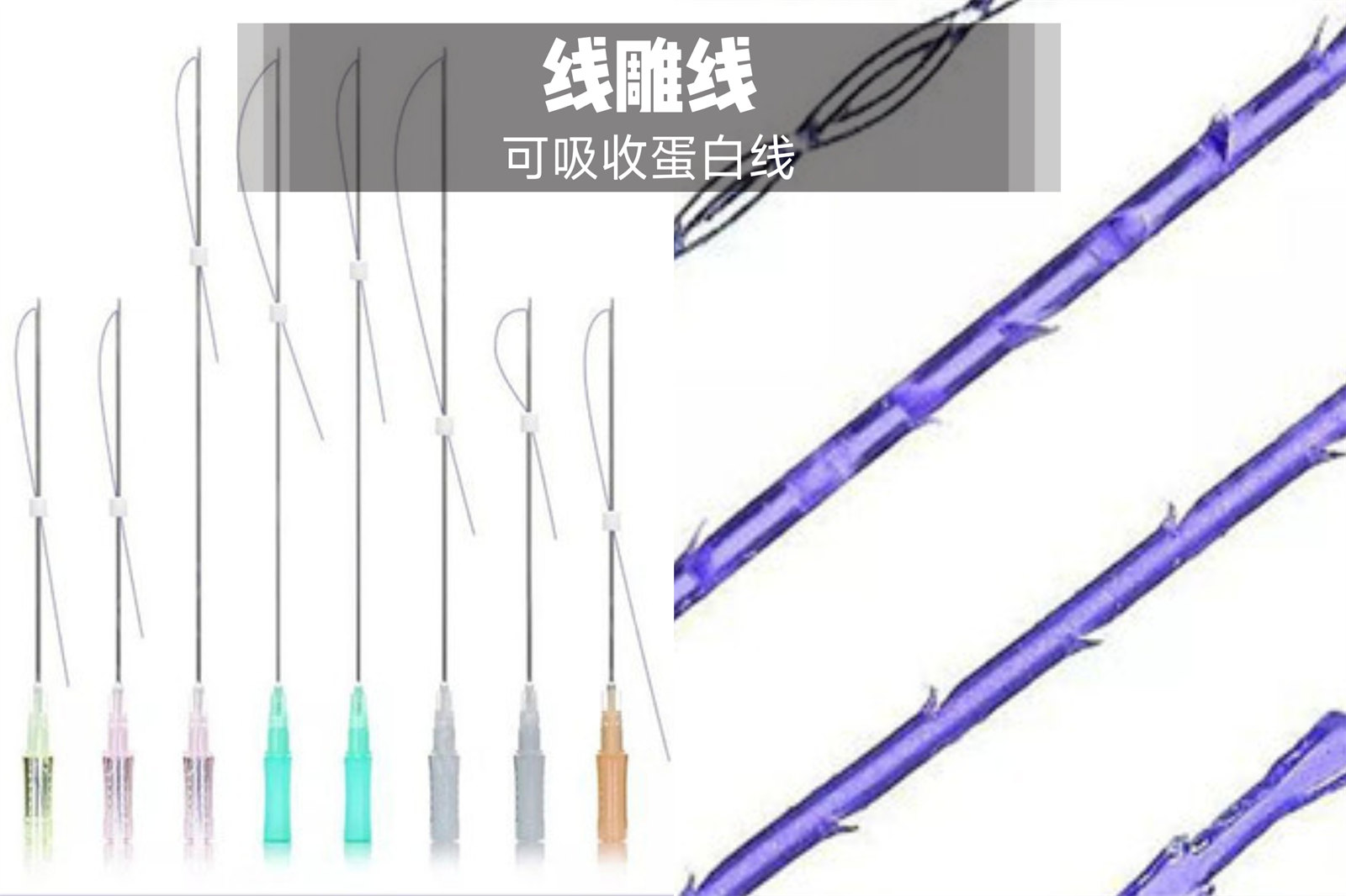 面部松弛下垂,线雕和拉皮手术究竟怎么选? 面部松弛下垂,线雕和拉皮手术究竟怎么选?