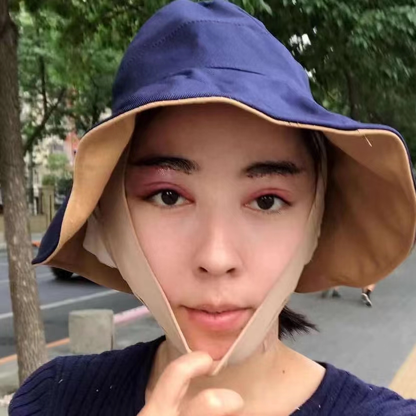 切眉术+小拉皮，微调之后的美，你觉得如何？