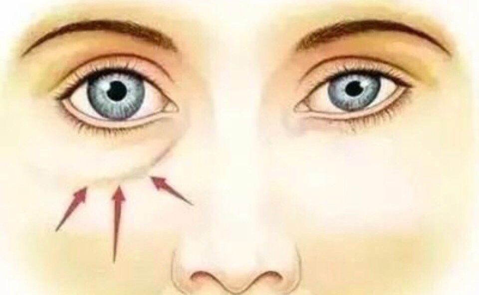 如何选择适合自己的眼部抗衰方式? 如何选择适合自己的眼部抗衰方式?