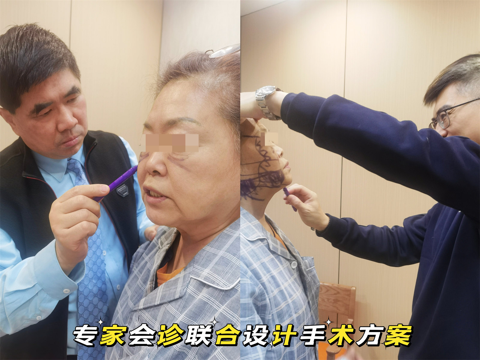 65岁做了吸脂+拉皮提升,发腮松弛一网打尽,效果好直接 65岁做了吸脂+拉皮提升,发腮松弛一网打尽,效果好直接