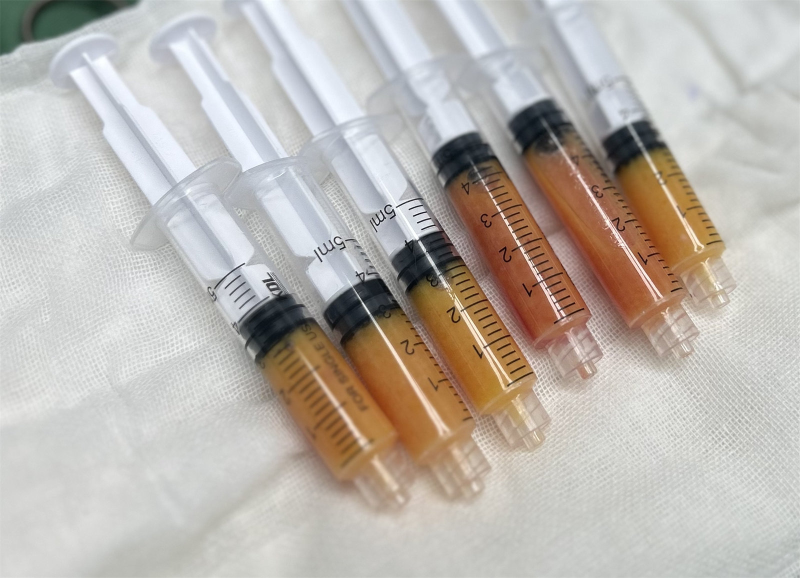 54岁求美者,为了变美奔赴北京做了拉皮提升,自己都被惊艳到 54岁求美者,为了变美奔赴北京做了拉皮提升,自己都被惊艳到