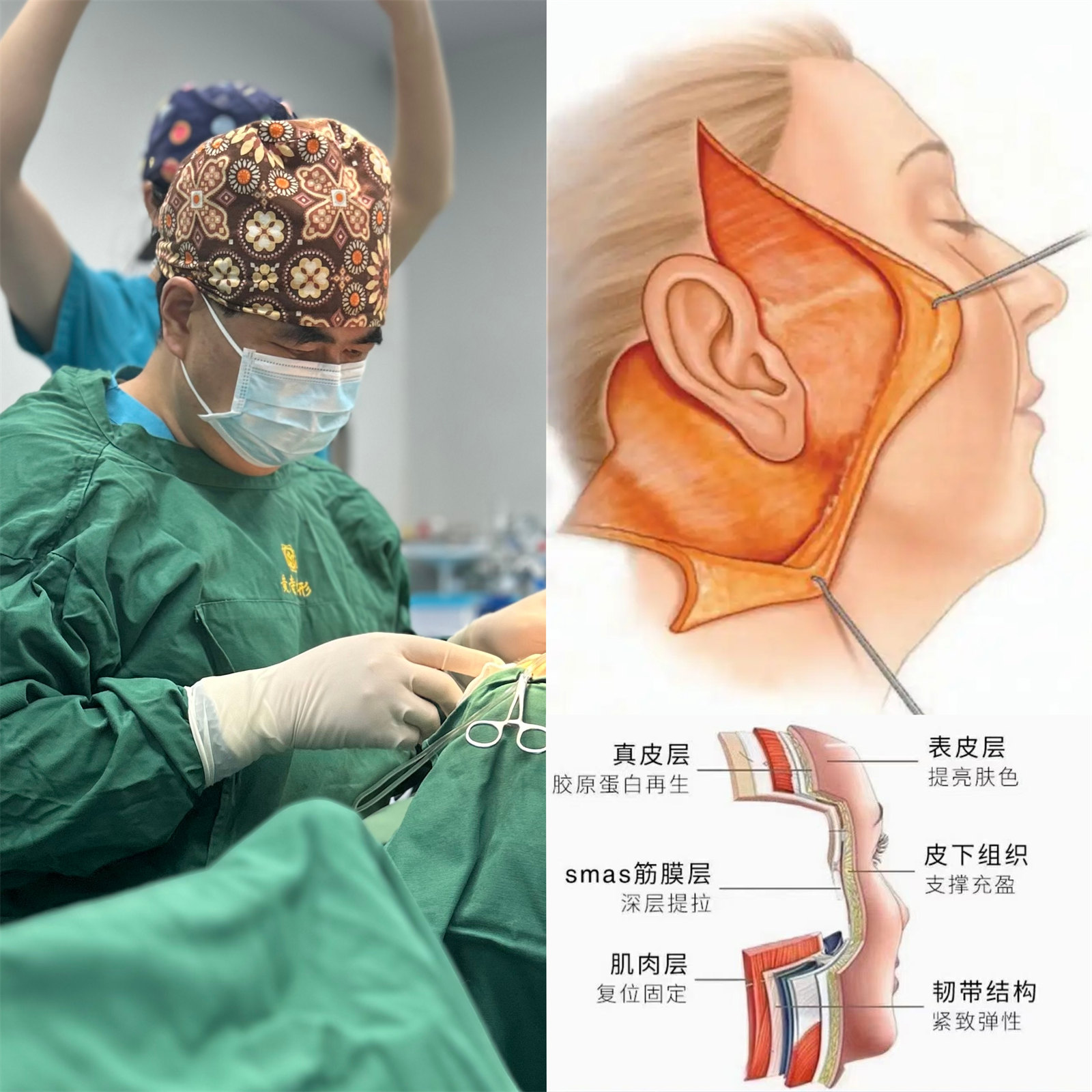 54岁求美者,为了变美奔赴北京做了拉皮提升,自己都被惊艳到 54岁求美者,为了变美奔赴北京做了拉皮提升,自己都被惊艳到