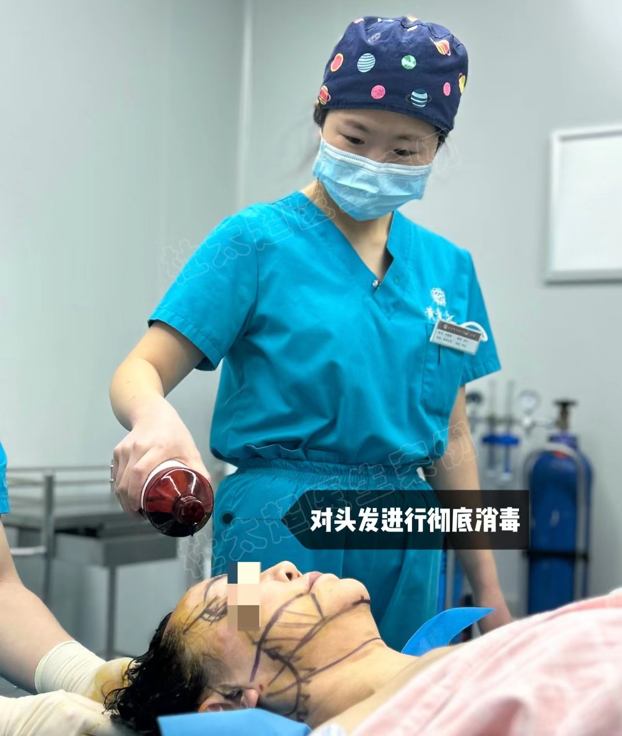 54岁豁出去做大拉皮,公开手术过程 54岁豁出去做大拉皮,公开手术过程