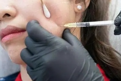 整形医生提醒你,40岁以后,这3个项目就别做了! 整形医生提醒你,40岁以后,这3个项目就别做了!