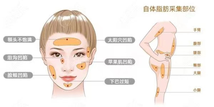 整形医生提醒你,40岁以后,这3个项目就别做了! 整形医生提醒你,40岁以后,这3个项目就别做了!