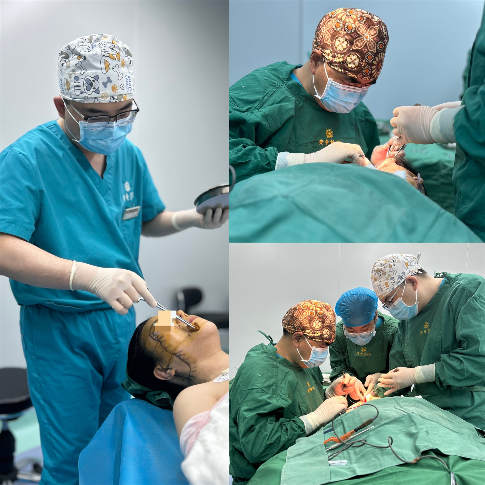 47岁苹果肌下垂，拉皮提升帮她扭转乾坤