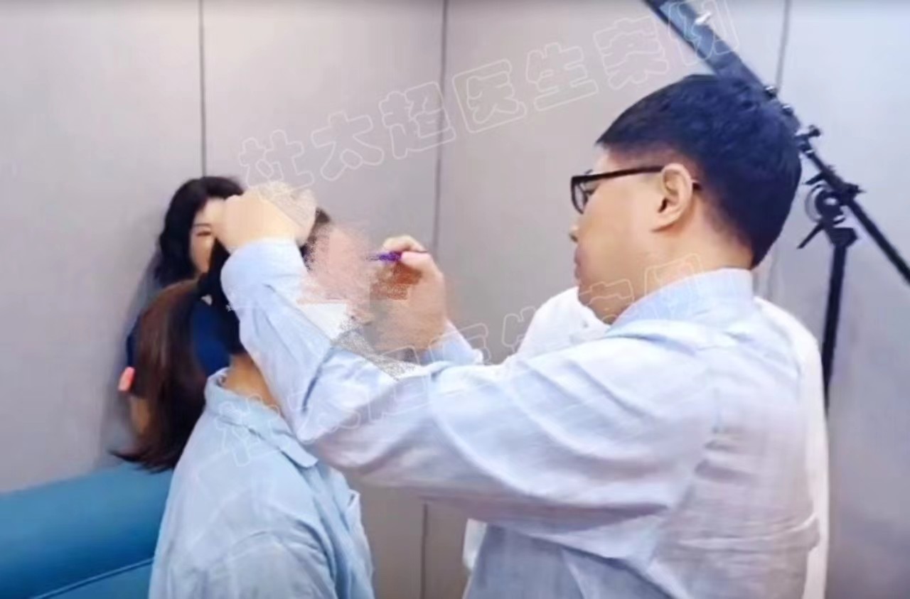 想年轻一些，但不想变化太大，医生为我这样设计