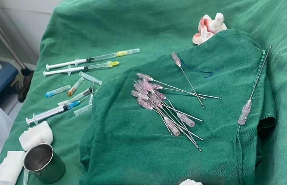 60岁专程到北京做拉皮手术，术后7天年龄成谜