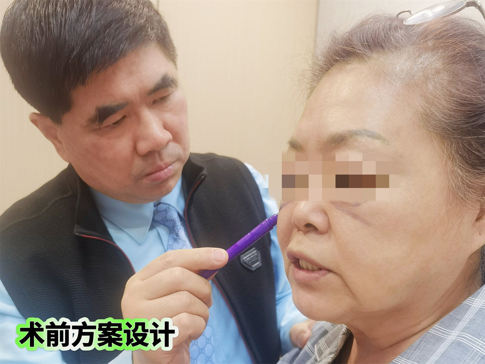 真人案例展示，拉皮确实比线雕强一万倍