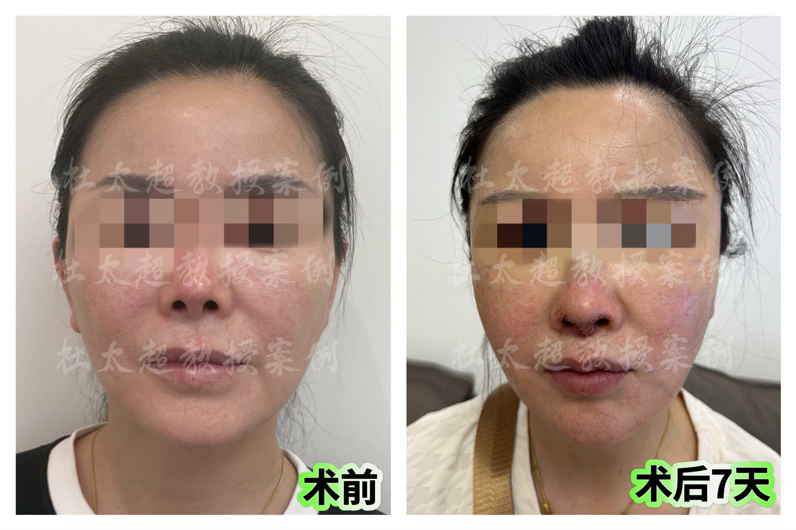 如何在52岁重焕青春——我选择了改变! 如何在52岁重焕青春——我选择了改变!