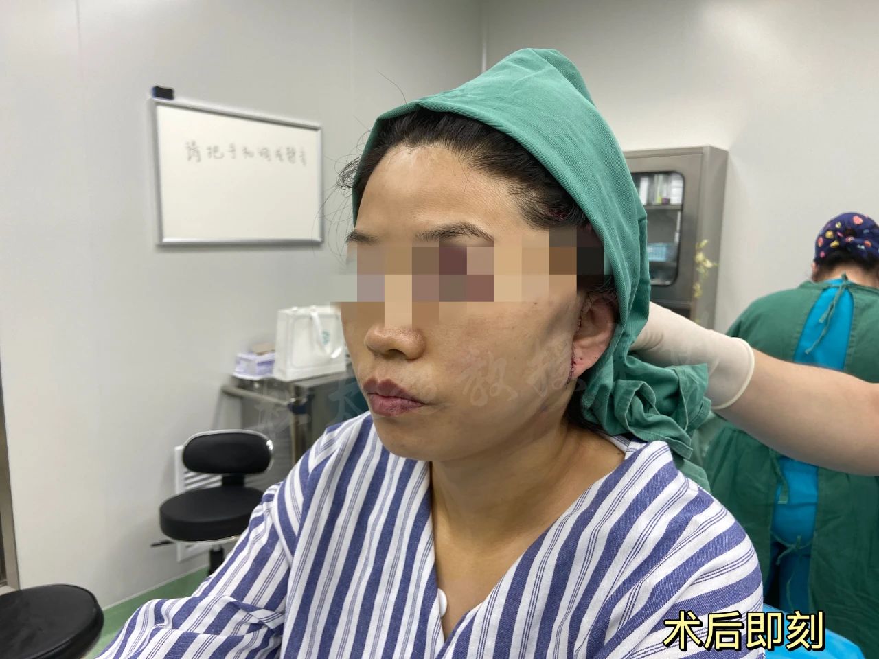 她说太丑!拉皮手术到底给她带来了什么,想要惊艳时光是痴心妄想? 她说太丑!拉皮手术到底给她带来了什么,想要惊艳时光是痴心妄想?