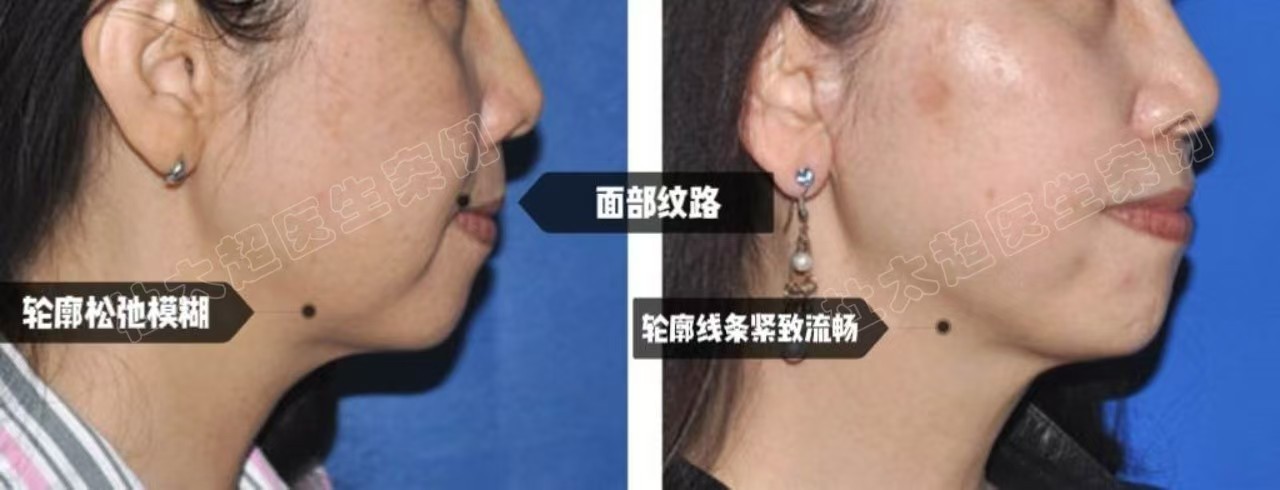 1726878386339734.jpg 微信图片_20240907100304.jpg