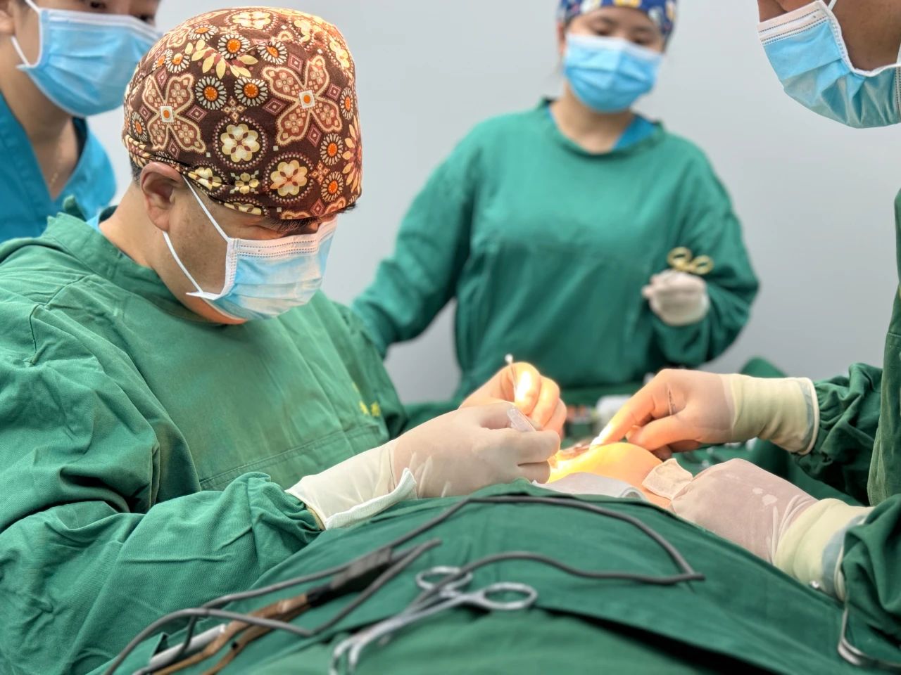 35岁做超声刀无效,转做拉皮,术后效果竟这样 35岁做超声刀无效,转做拉皮,术后效果竟这样