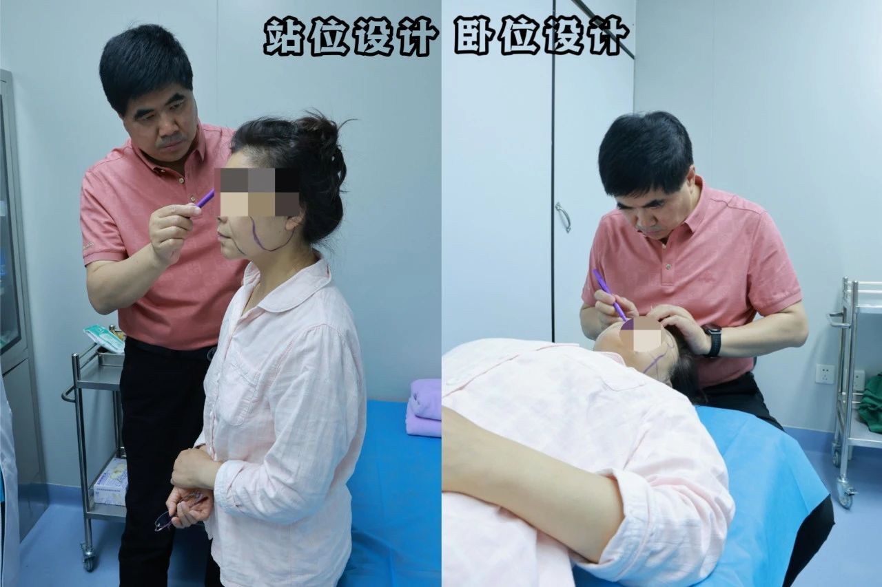 拉皮手术可不是“一刀切”那么简单,里头学问大着哦! 拉皮手术可不是“一刀切”那么简单,里头学问大着哦!