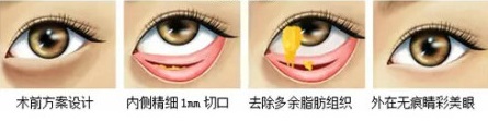 眼袋松弛下垂，如何有效解决？