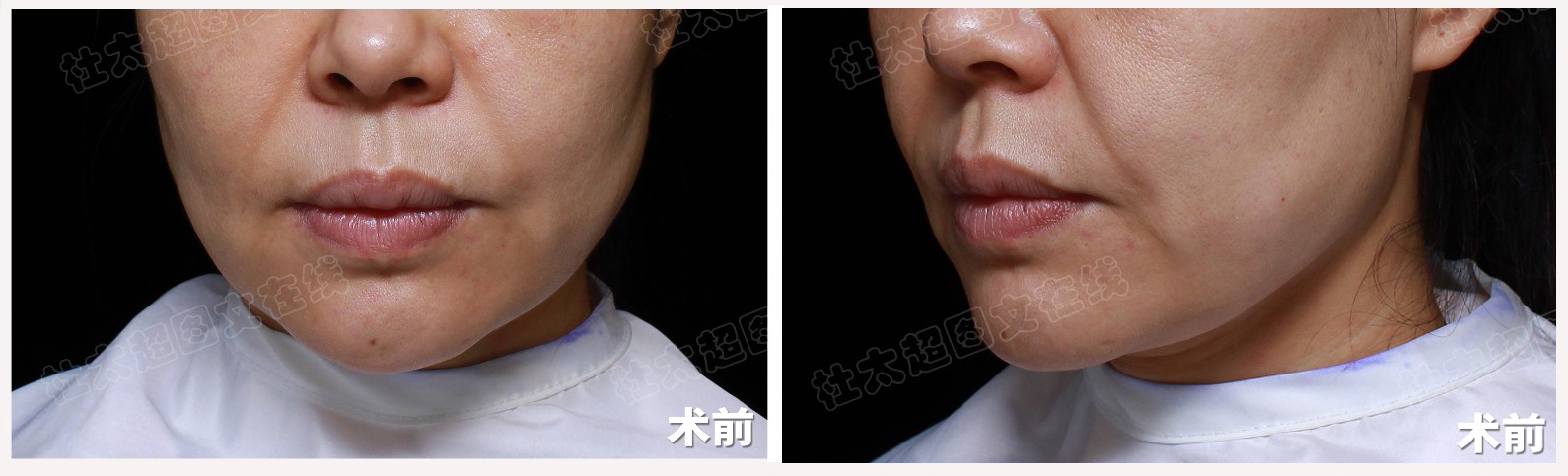 憔悴上班族的精致减龄秘籍公开，方法其实很简单