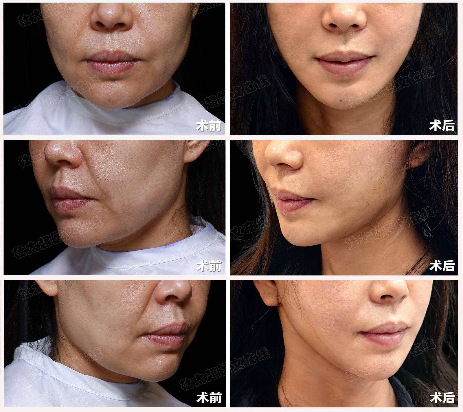 憔悴上班族的精致减龄秘籍公开，方法其实很简单