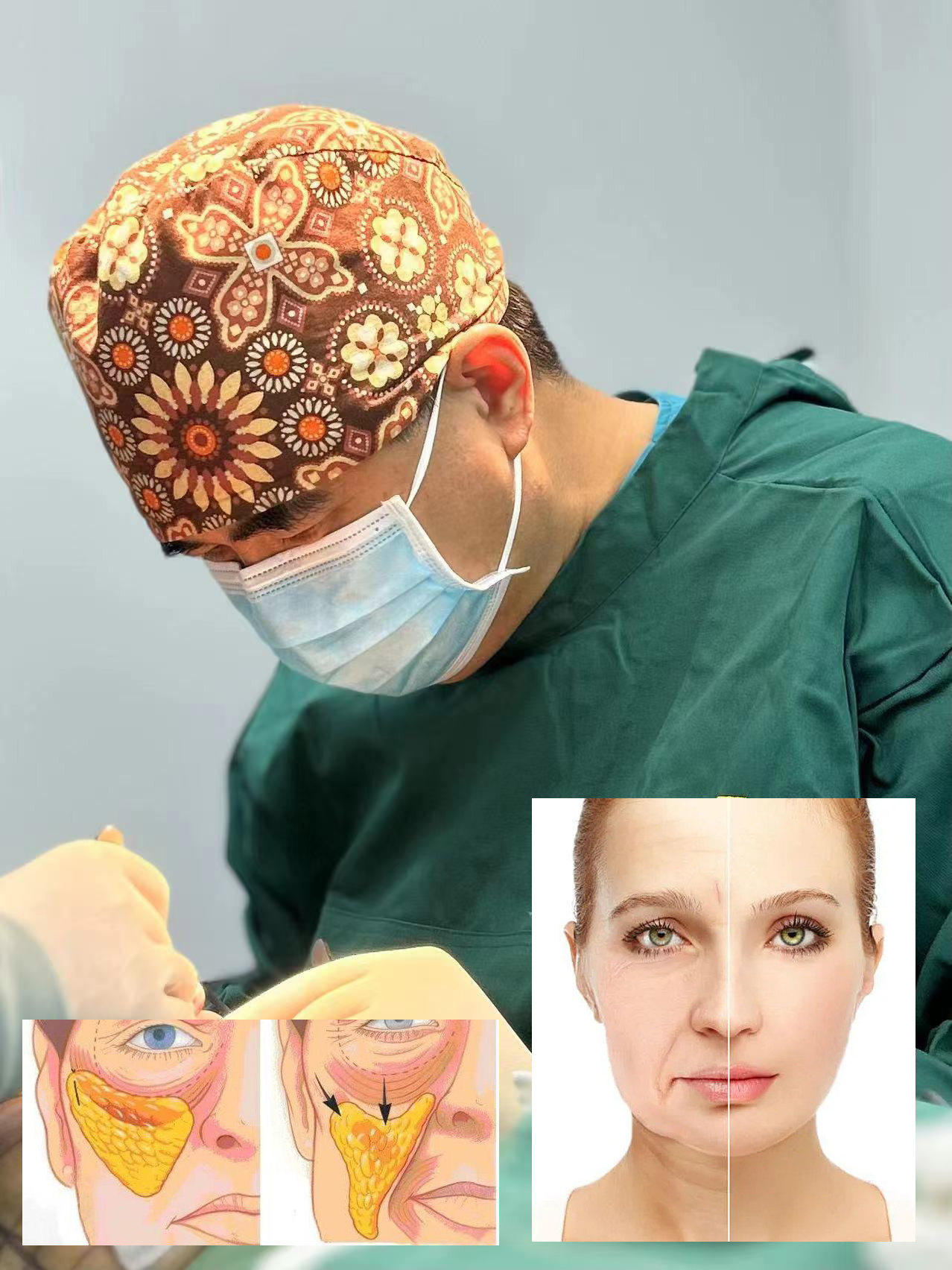 面部抗衰，如何把钱花在刀刃上？