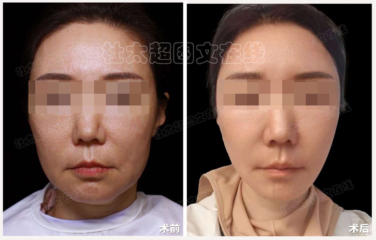 1735894039194719.jpg 3.jpg