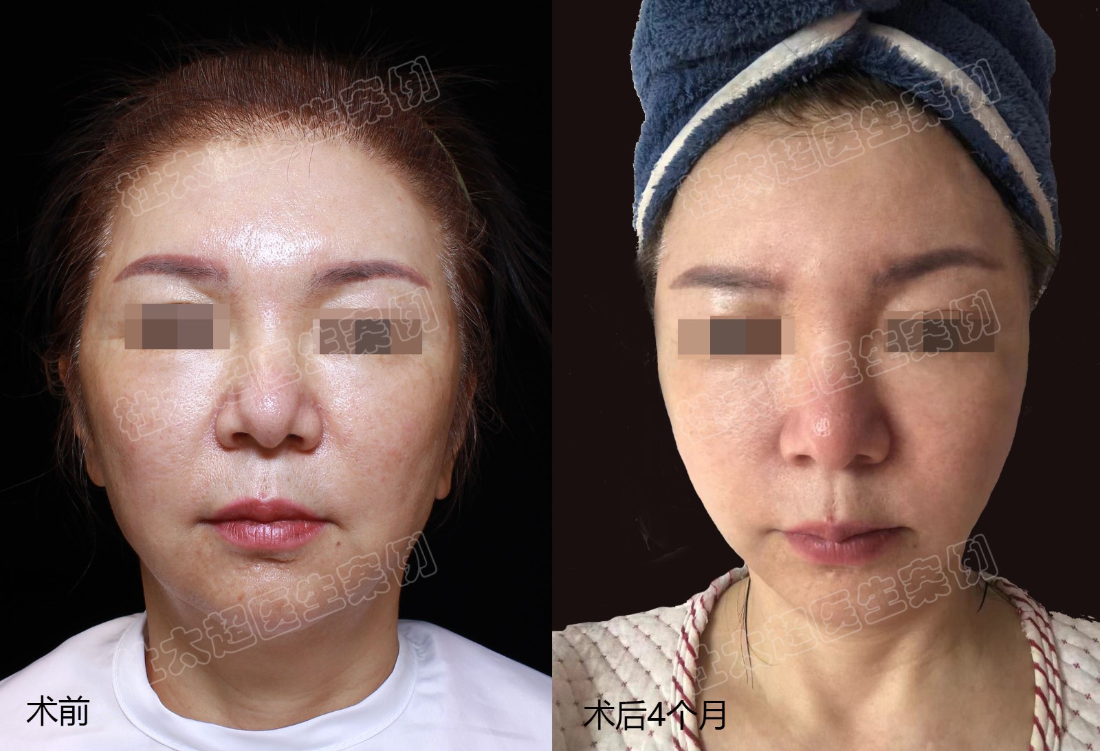 1736149063198186.jpg 4.jpg