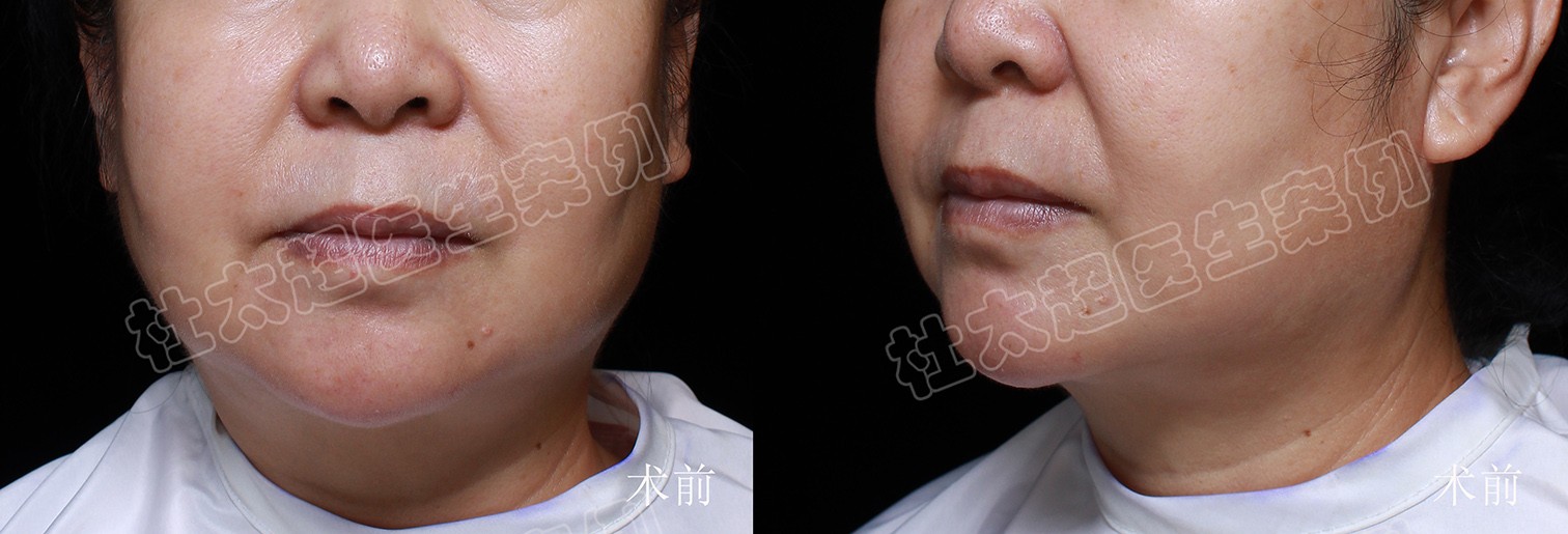 1736559943195075.jpg 1.jpg