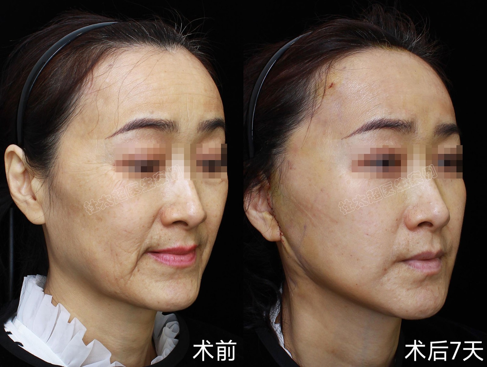 1736840658198929.jpg 张晓杰.jpg