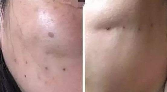 1737705932186988.jpg 2.jpg