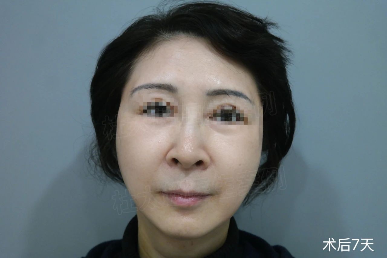 1738833484813986.jpg 微信图片_20250206171153.jpg