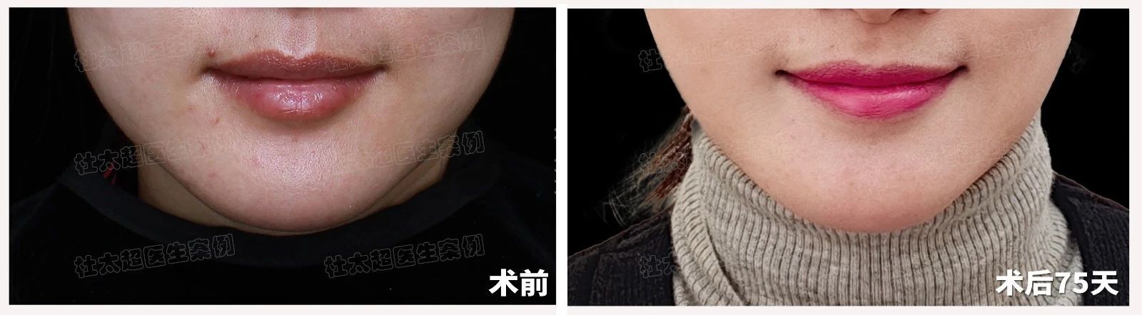 1738833790154663.jpg 微信图片_20250206172111.jpg