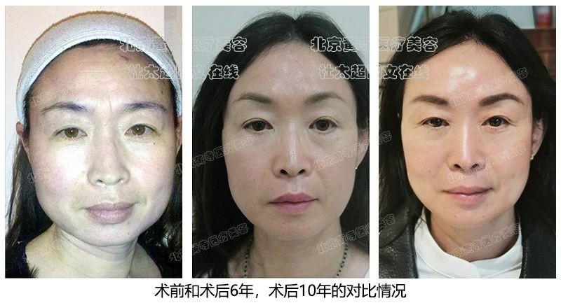 1739235910154708.jpg 微信图片_20250211090342.jpg