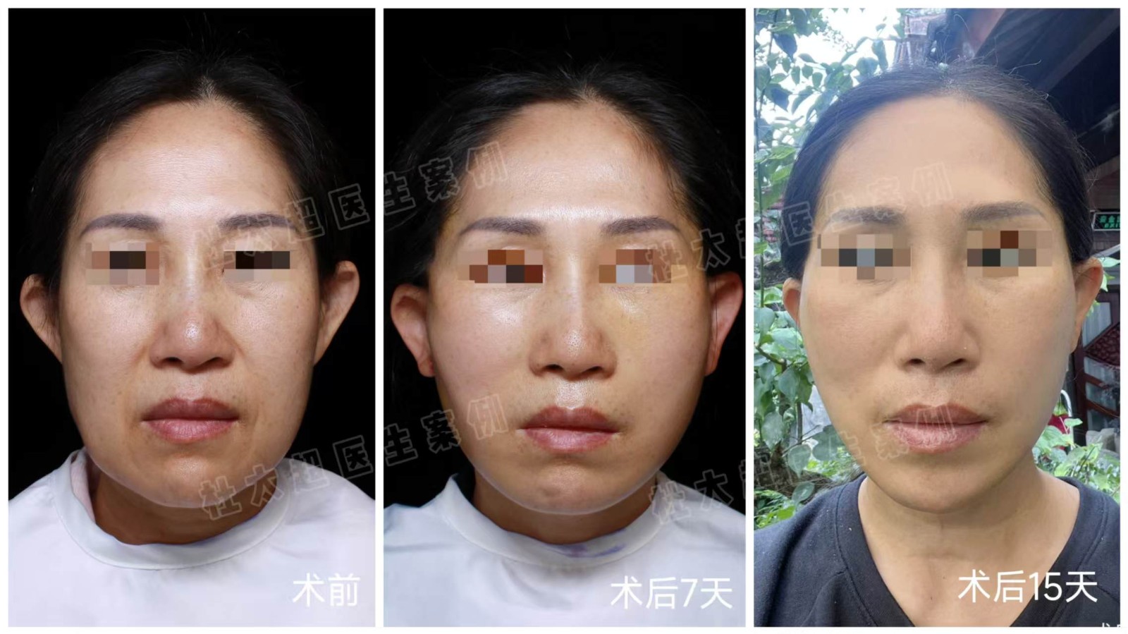 1739345053783010.jpg 微信图片_20250212145828.jpg