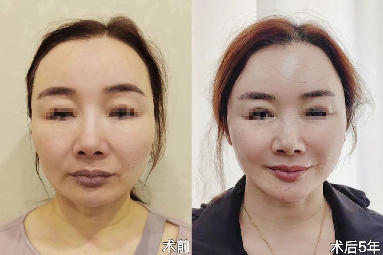 1739440020359730.jpg 微信图片_20250213174325.jpg