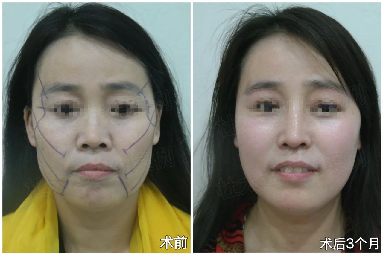 1739585869135898.jpg 微信图片_20250215101520.jpg