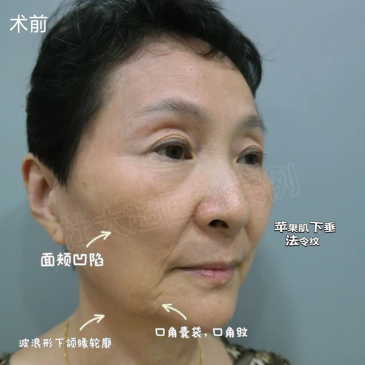 1739839054173418.jpg 微信图片_20250218083551.jpg