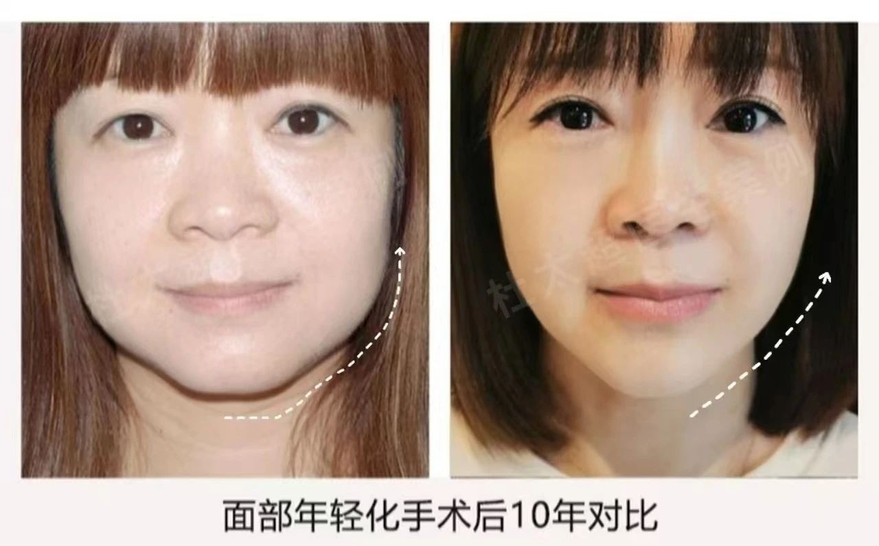 1739839077509620.jpg 微信图片_20250218083555.jpg