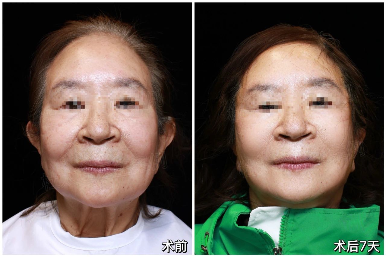 1741432682152537.jpg 微信图片_20250308191606.jpg