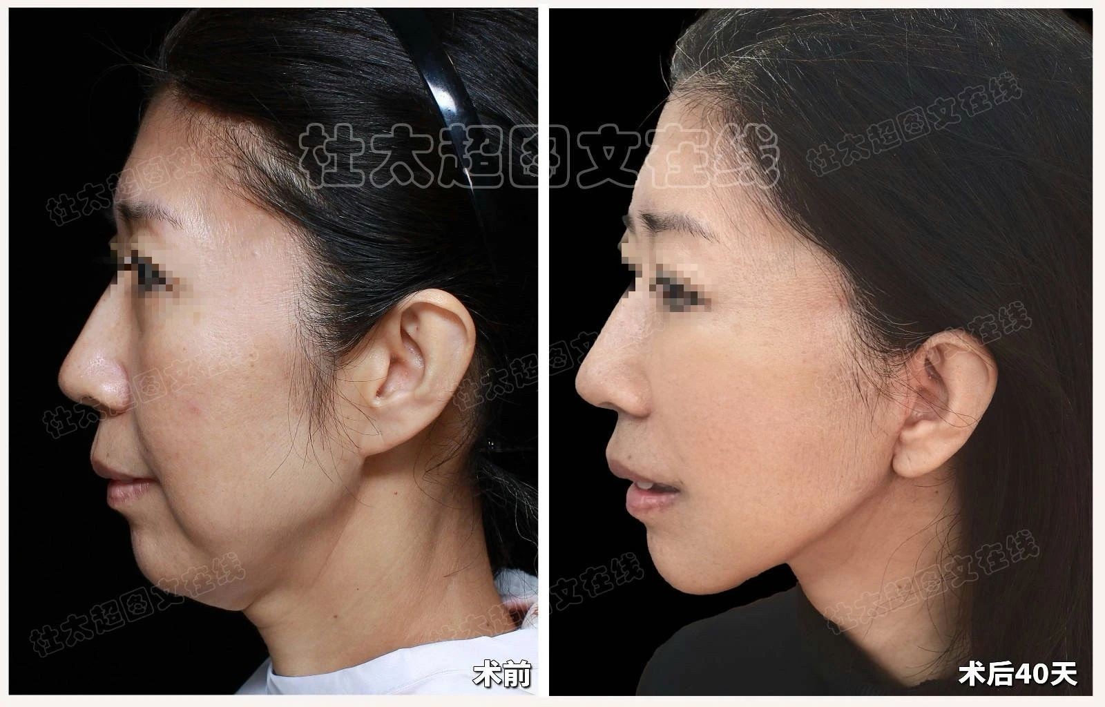 1742223920230210.jpg 微信图片_20250317230008.jpg