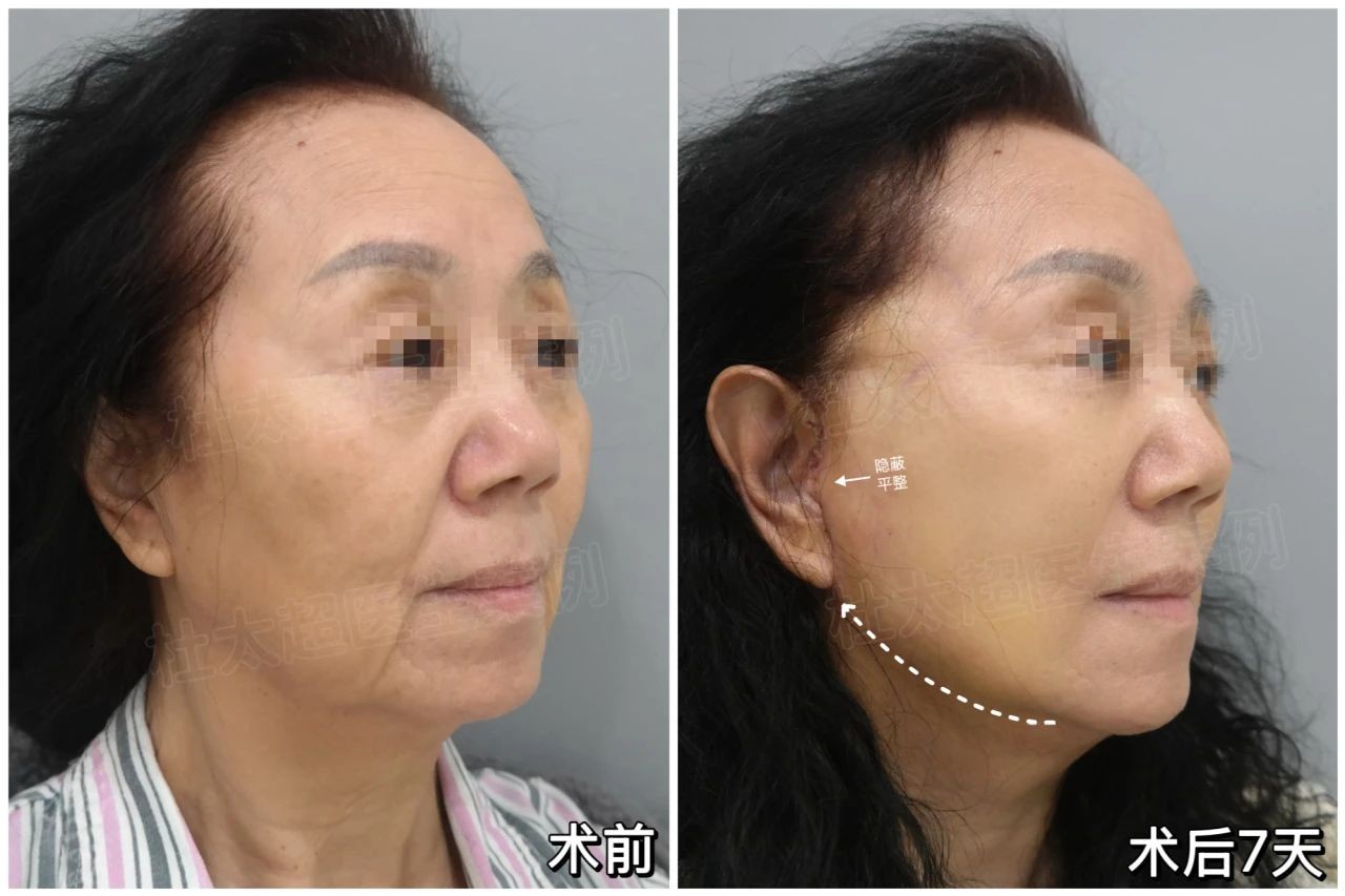 1742779255106535.jpg 微信图片_20250324085841.jpg