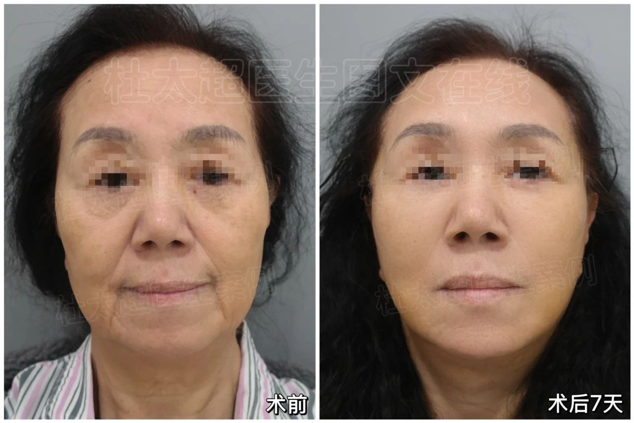 1742779255194421.jpg 微信图片_20250324085839.jpg