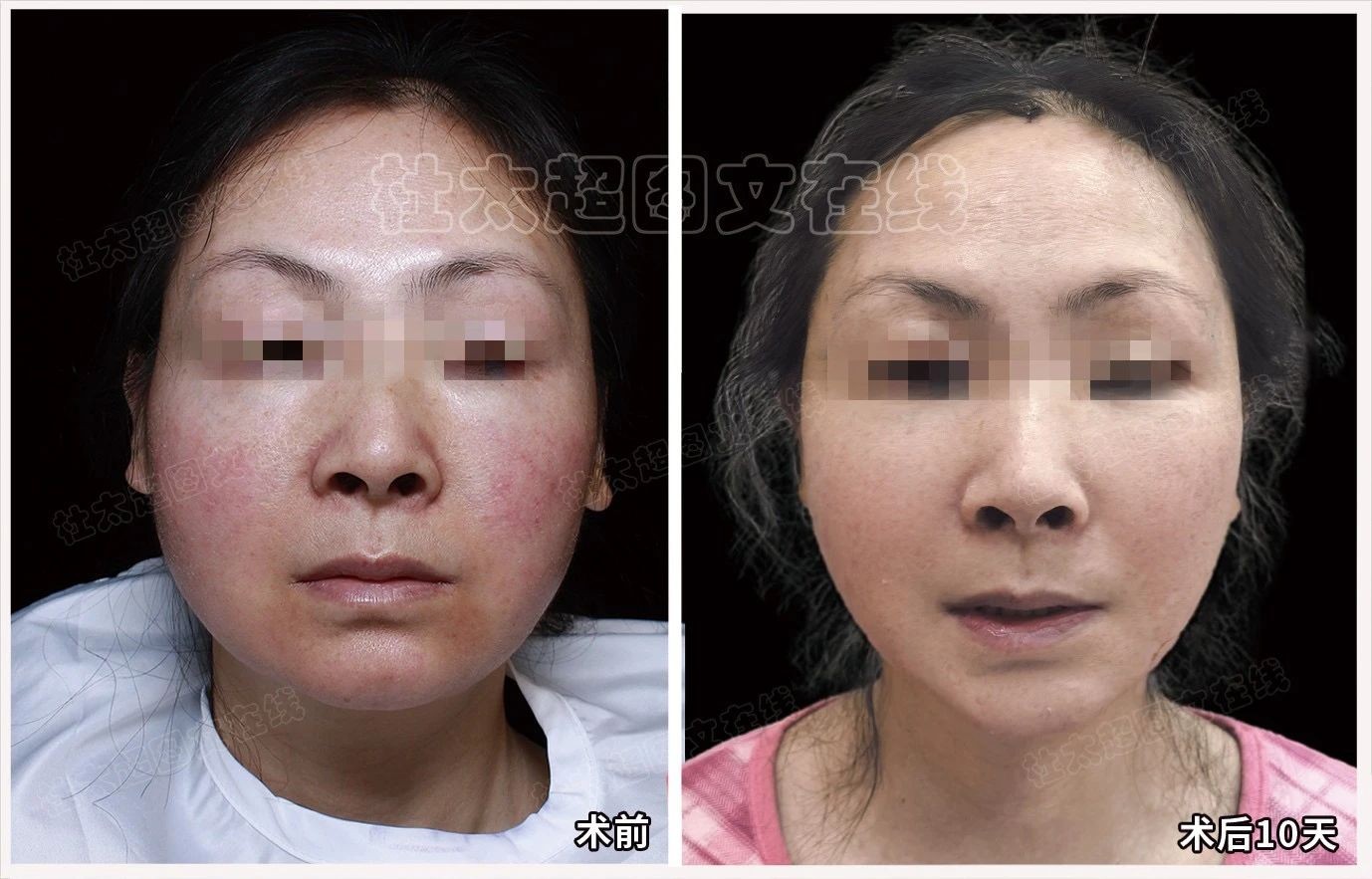 1743088430120282.jpg 微信图片_20250327231237.jpg