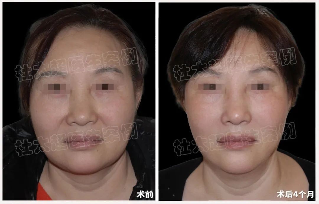 1744207581534956.jpg 微信图片_20250409220612.jpg