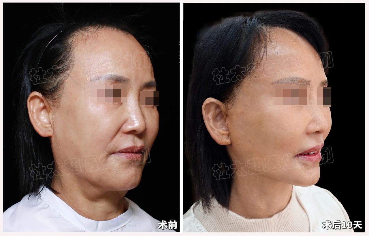 1744209287130429.jpg 微信图片_20250409223451.jpg