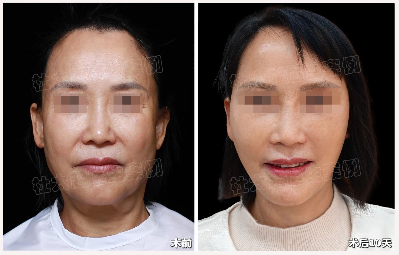 1744209287118315.jpg 微信图片_20250409223447.jpg