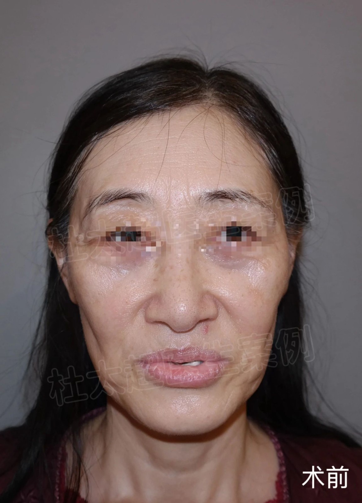 1744295017181650.jpg 微信图片_20250410222311.jpg