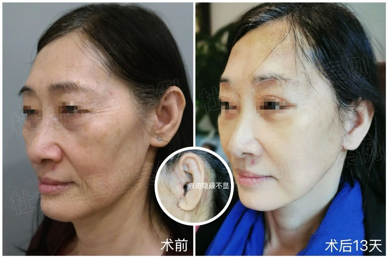 1744295272556933.jpg 微信图片_20250410222413.jpg