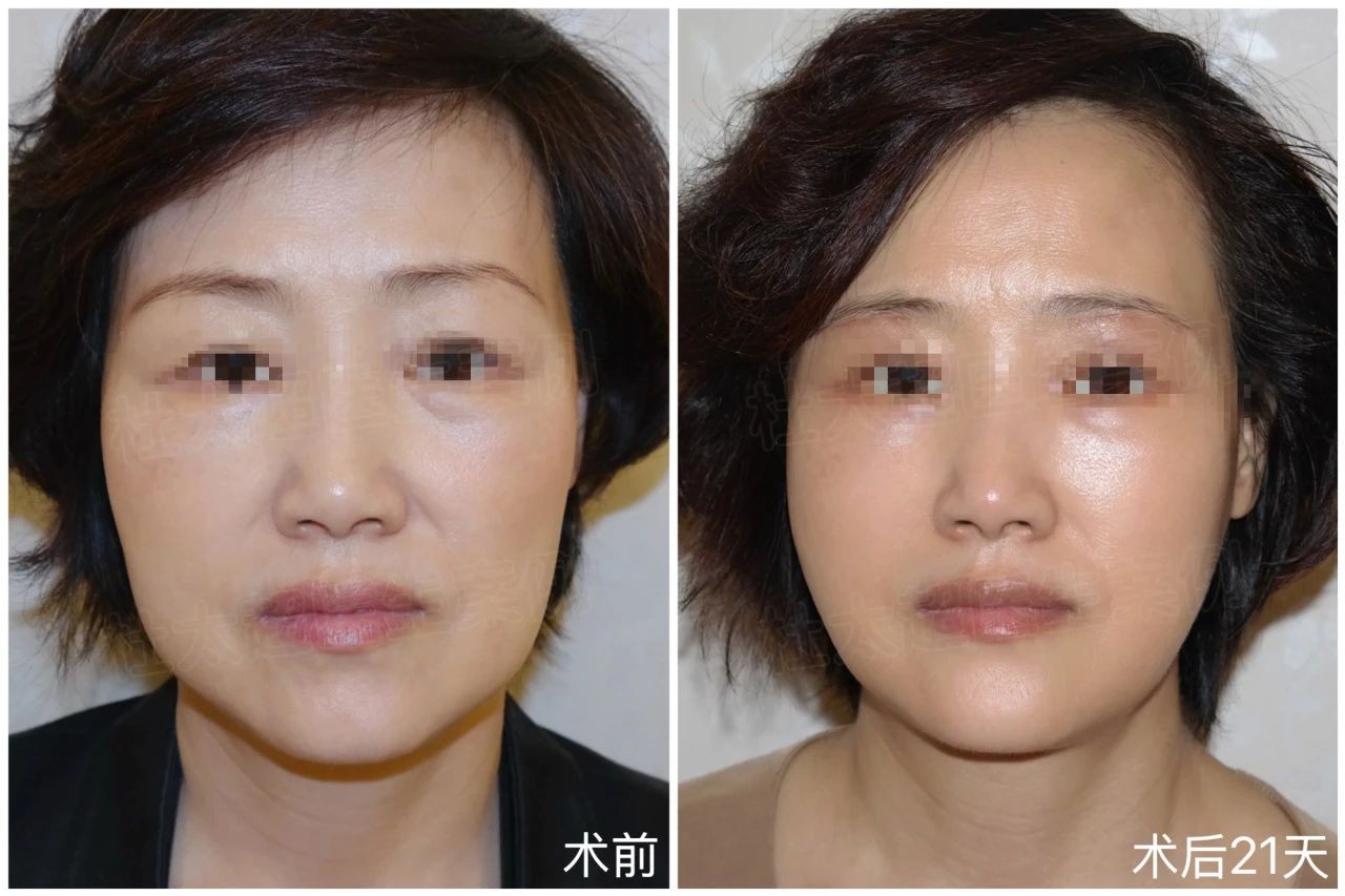 1744296043820578.jpg 微信图片_20250410224052.jpg