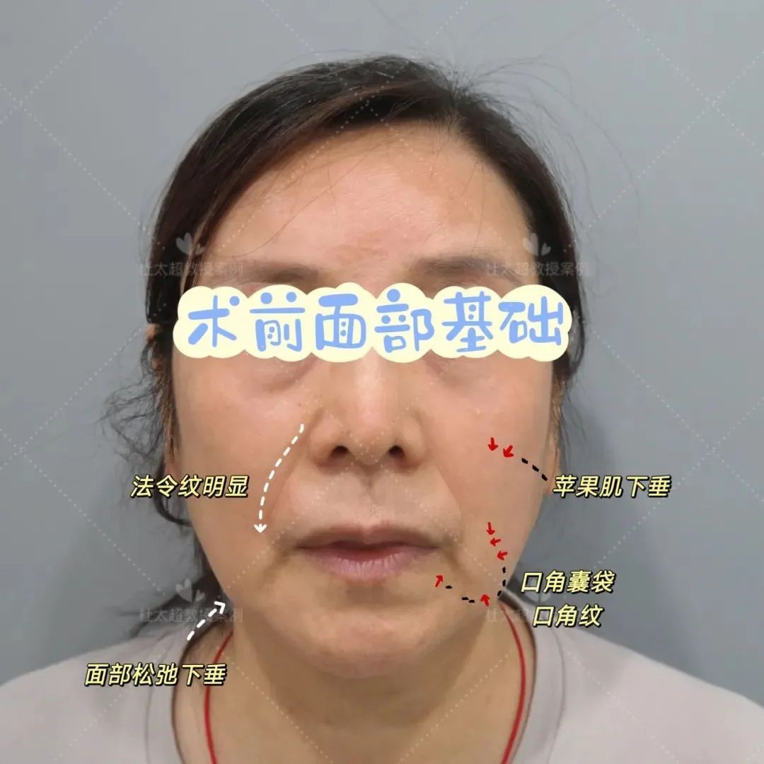 1744708962193546.jpg 微信图片_20250415172217.jpg