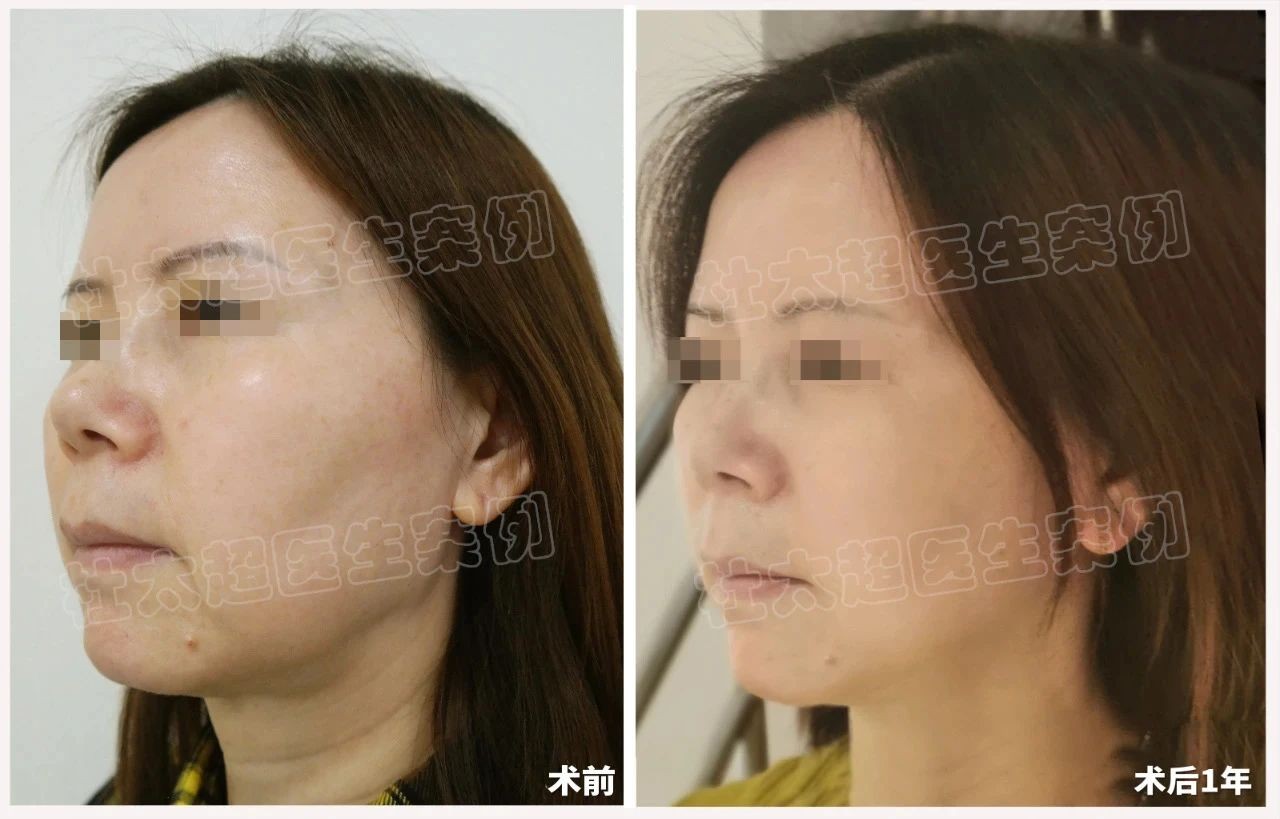 1745105252204475.jpg 微信图片_20250420072459.jpg